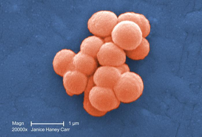 Eine mikroskopische Ansicht von Streptococcus mitus Bakterien, die als kleine, runde, perlmuttartige Strukturen erscheinen, die sich in Clustern oder Ketten anordnen.